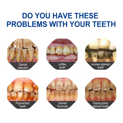 Teeth Whitening Pen Serum Oral Care Tooth Whitener Painless Gum Therapy No Sensitivity Instant Stain Remover Teeth Bleaching Gel